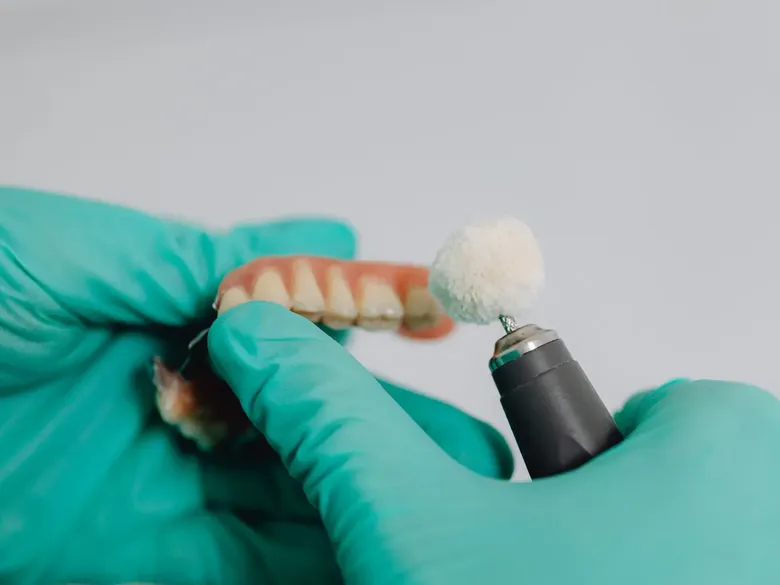 Implantes dentales: mitos y verdades que debes conocer