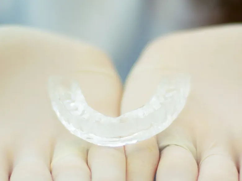 Retenedores después de los brackets: por qué importan y cuánto tiempo usarlos