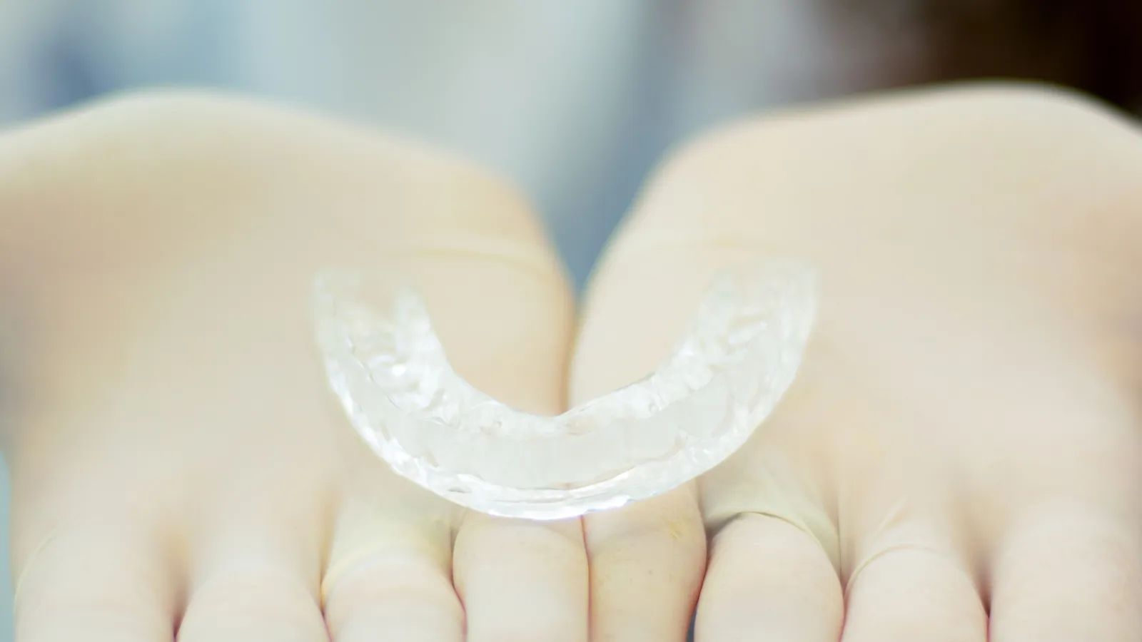 Retenedores después de los brackets: por qué importan y cuánto tiempo usarlos