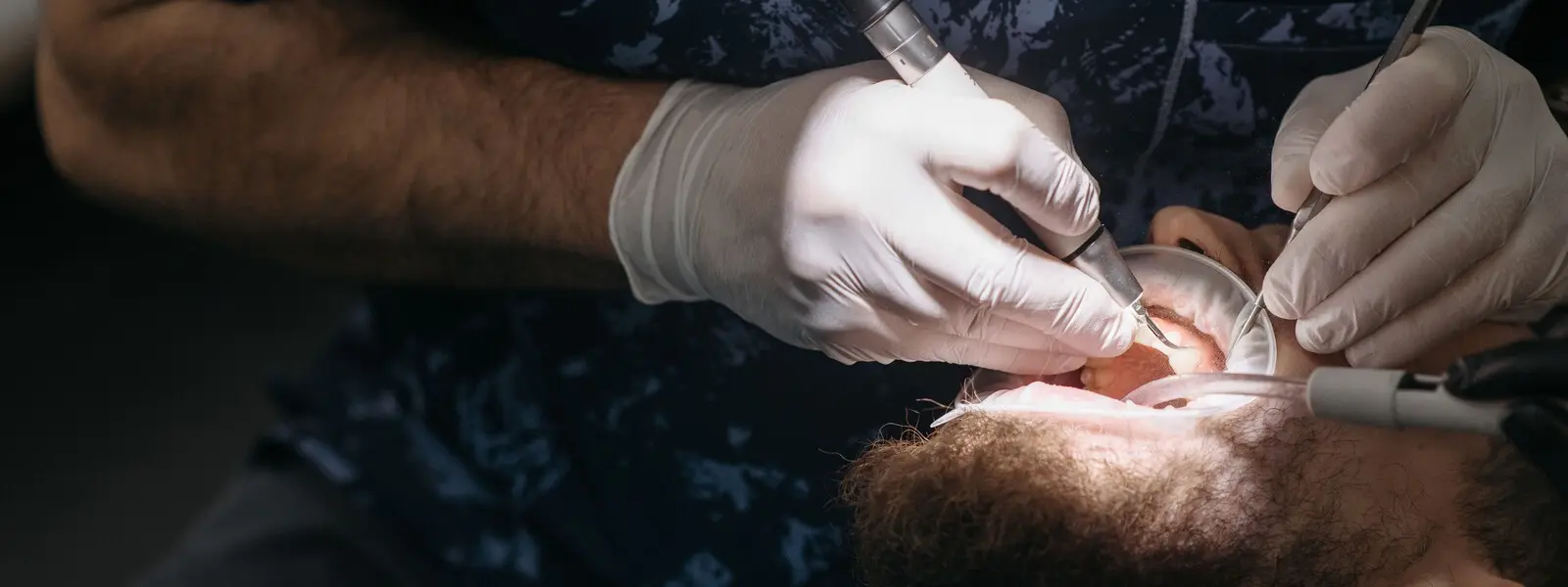 Cirugía Bucal y Maxilofacial