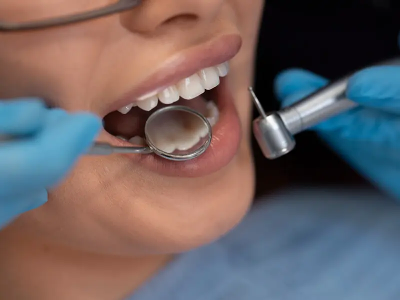 Detalle de Odontología General en Planident