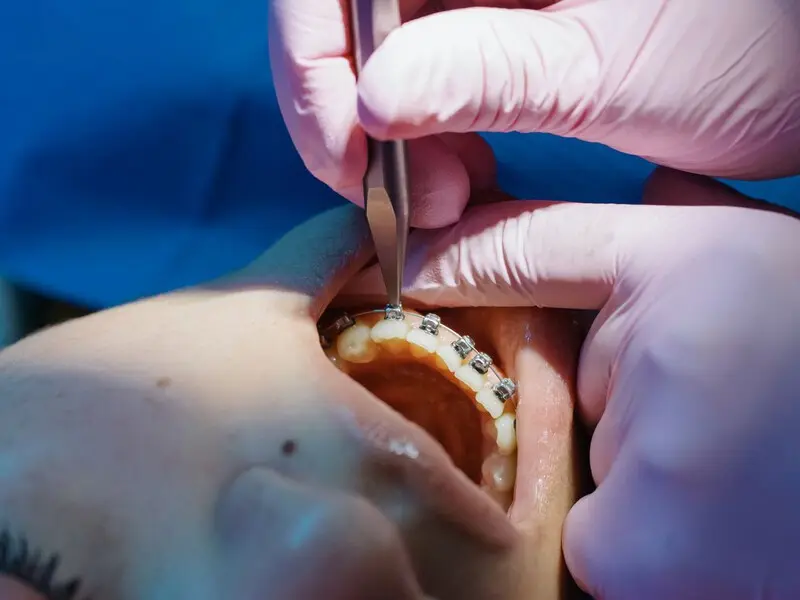 Detalle de Ortodoncia en Planident