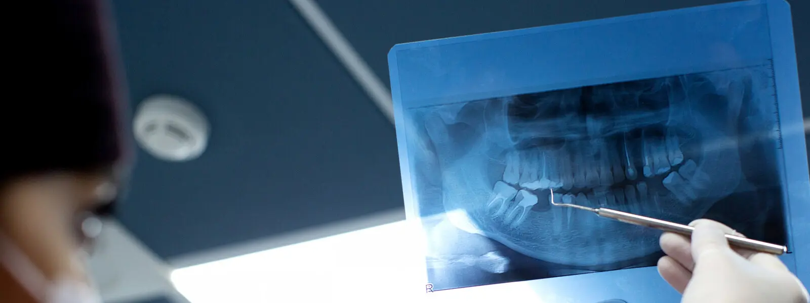 Radiología e Imágenes Bucales