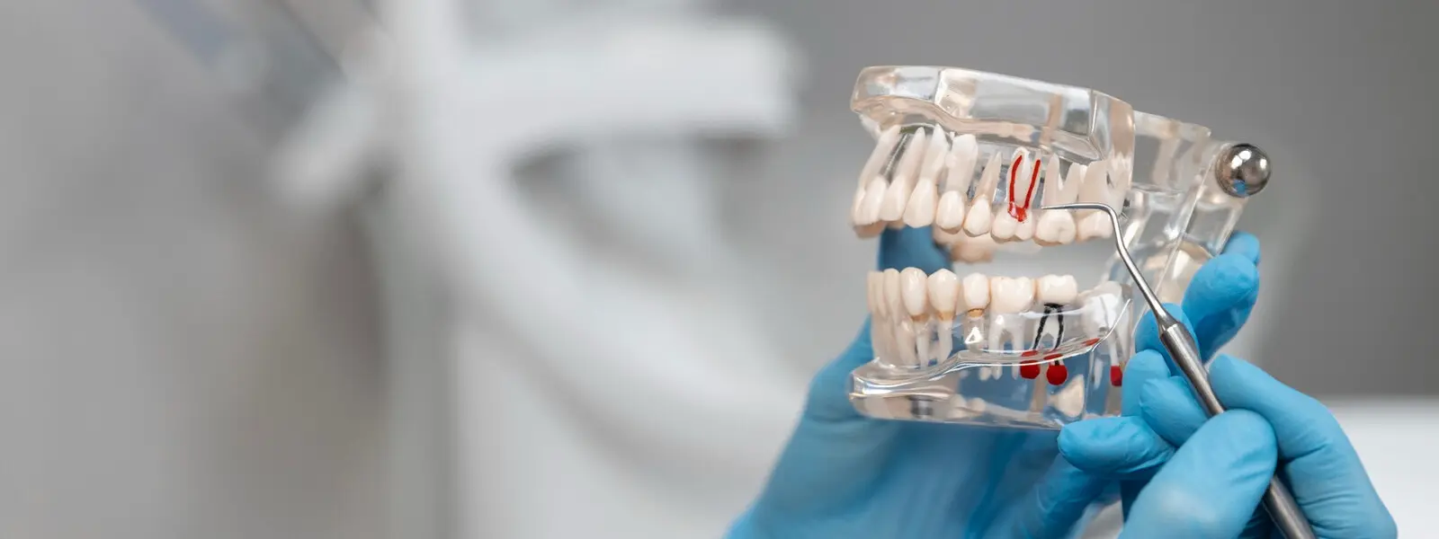 Rehabilitación Oral